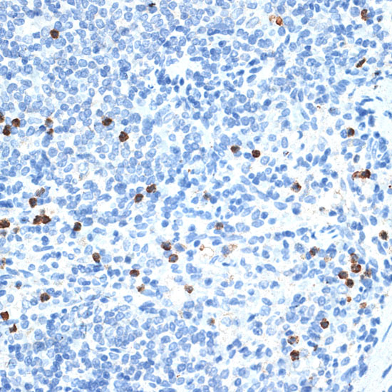 Immunohistochemistry of paraffinembedded rat spleen using MMP9 antibody at dilution of 1:100 (40x lens).Perform microwave antigen retrieval with 10 mM PBS buffer pH 7.2 before commencing with IHC staining protocol.
