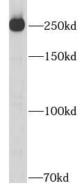 Human plasma tissue were subjected to SDS PAGE followed by western blot with Fibronectin antibody at dilution of 1:6000