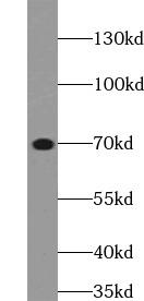 Mouse lung tissue were subjected to SDS PAGE followed by western blot with Elastin Antibody at dilution of 1:500