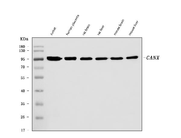 Western blot analysis of Calnexin/CANX using anti- Calnexin/CANX antibody.
Electrophoresis was performed on a 5-20% SDS-PAGE gel at 70V (Stacking gel) / 90V (Resolving gel) for 2-3 hours. The
sample well of each lane was loaded with 30 ug of sample under reducing conditions.
Lane 1: human Jurkat whole cell lysates, Lane Lane 2: human placenta tissue lysates,
Lane 3: rat brain tissue lysates,
Lane 4: rat liver tissue lysates,
Lane 5: mouse brain tissue lysates,
Lane 6: mouse liver tissue lysates.
After electrophoresis, proteins were transferred to a nitrocellulose membrane at 150 mA for 50-90 minutes.
Blocked the membrane with 5% non-fat milk/TBS for 1.5 hour at RT. The membrane was incubated with mouse anti-
Calnexin/CANX antigen affinity purified monoclonal antibody at 1:1000 overnight at 4°C, then washed with TBS-0.1%Tween 3 times with 5 minutes each and probed with a goat anti-mouse IgG-HRP secondary antibody at a dilution of 1:10000 for 1.5 hour at RT. The signal is developed using an Enhanced Chemiluminescent detection (ECL) kit with Tanon 5200 system. A specific band was detected for Calnexin/CANX at approximately 95 kDa. The expected band size for Calnexin/CANX is at 67 kDa.