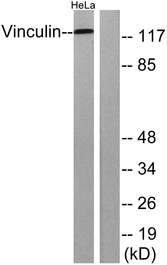 Western blot analysis of lysates from HeLa cells, treated with forskolin 40nM 30', using Vinculin Antibody. The lane
on the right is blocked with the synthesized peptide.