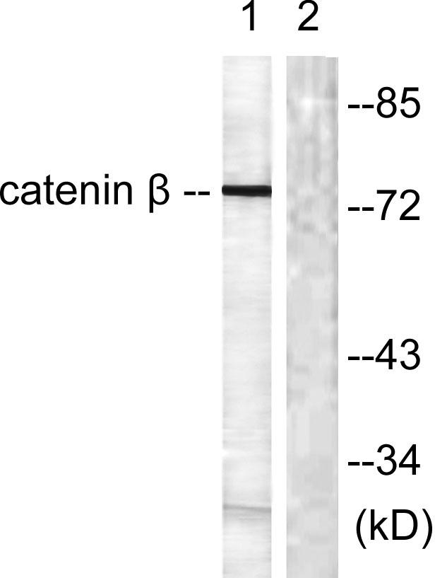 Western blot analysis of lysates from rat brain cells, using Catenin-beta Antibody. The lane on the right is blocked
with the synthesized peptide.