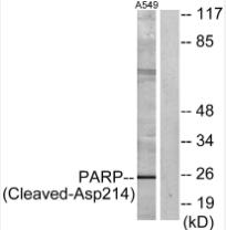 Western blot analysis of lysates from A549 cells, treated with etoposide 25uM 24h, using PARP (Cleaved-Asp214) Antibody.
The lane on the right is blocked with the synthesized peptide.