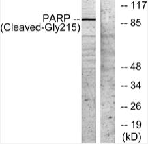 Western blot analysis of lysates from NIH/3T3 cells, treated with etoposide 25uM 1h, using PARP (Cleaved-Gly215) Antibody. The lane on the right is blocked with the synthesized peptide.
