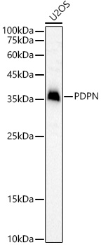 Western blot analysis of U2OS, using PDPN antibodyat 1:1000 dilution.
Secondary antibody: HRP Goat Anti-Rabbit IgG (H+L) at 1:10000 dilution.
Lysates/proteins: 25ug per lane.
Blocking buffer: 3% nonfat dry milk in TBST.
Detection: ECL West Pico Plus.
Exposure time: 30s.