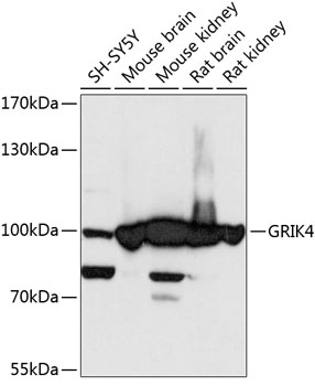 Western blot analysis of extracts of various cell lines, using GRIK4 antibody at 1:3000
dilution.
Secondary antibody: HRP Goat Anti-Rabbit IgG (H+L) at 1:10000 dilution.
Lysates/proteins: 25ug per lane.
Blocking buffer: 3% nonfat dry milk in TBST.
Detection: ECL West Pico Plus.
Exposure time: 10s.