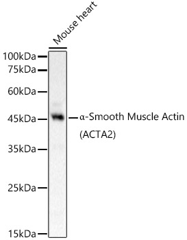 Western blot analysis of Mouse heart, using α-Smooth Muscle Actin (ACTA2) antibody  at 1:800 dilution.
Secondary antibody: HRP Goat Anti-Rabbit IgG (H+L) at 1:10000 dilution.
Lysates/proteins: 25ug per lane.
Blocking buffer: 3% nonfat dry milk in TBST.
Detection: ECL West Pico Plus.
Exposure time: 10s.