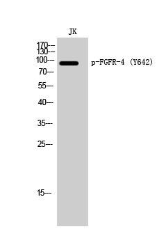 Western Blot analysis of JK cells using Phospho-FGFR-4 (Y642) Polyclonal Antibody