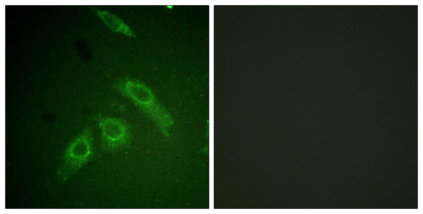 Immunofluorescence analysis of HepG2 cells, using FAK (Phospho-Ser910) Antibody. The picture on the right is blocked with the phospho peptide.