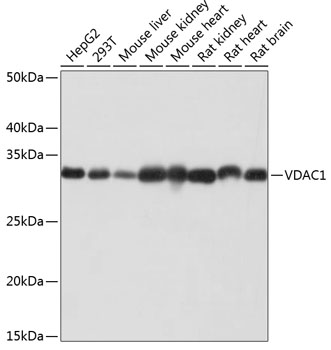 <span dir="ltr" role="presentation">Western blot analysis of extracts of various cell lines, using VDAC1 antibody at 1:1000 </span><span dir="ltr" role="presentation">dilution.</span><br role="presentation" /><span dir="ltr" role="presentation">Secondary antibody: HRP Goat Anti-Rabbit IgG (H+L) at 1:10000 dilution.</span><br role="presentation" /><span dir="ltr" role="presentation">Lysates/proteins: 25ug per lane.</span><br role="presentation" /><span dir="ltr" role="presentation">Blocking buffer: 3% nonfat dry milk in TBST.</span><br role="presentation" /><span dir="ltr" role="presentation">Detection: ECL Basic Kit </span><br role="presentation" /><span dir="ltr" role="presentation">Exposure time: 1s.</span>