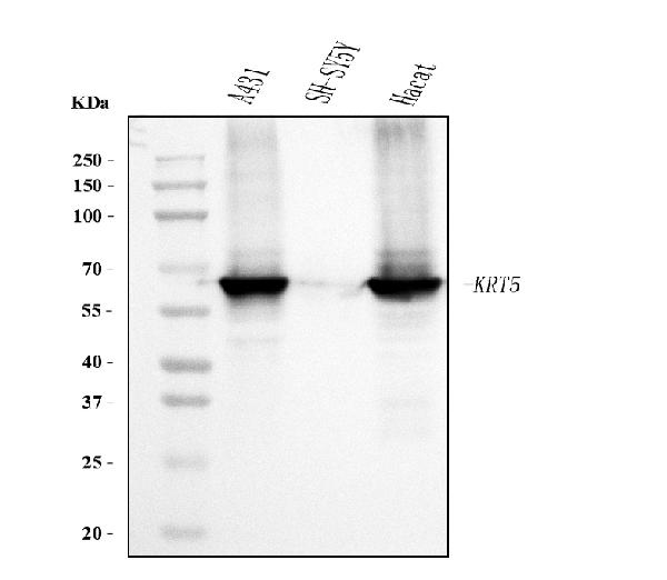 Western blot analysis of Cytokeratin 5 using anti- Cytokeratin 5 antibody.
Electrophoresis was performed on a 5-20% SDS-PAGE gel at70V (Stacking gel) / 90V (Resolving gel) for 2-3 hours. The
sample well of each lane was loaded with 30 ug of sampleunder reducing conditions.
Lane 1: human A431 whole cell lysates
Lane 2: human SH-SY5Y whole cell lysates
Lane 3: human Hacat whole cell lysates. After electrophoresis, proteins were transferred to a
nitrocellulose membrane at 150 mA for 50-90 minutes. Blocked the membrane with 5% non-fat milk/TBS for 1.5 hour at RT. The membrane was incubated with mouse anti- Cytokeratin 5 antigen affinity purified monoclonal antibody at 0.5 ug/mL overnight at 4°C, then washed with TBS-0.1%Tween 3 times with 5 minutes each and probed with a goat anti-mouse IgG-HRP secondary antibody at a dilution of 1:10000 for 1.5 hour at RT. The signal is developed using an Enhanced Chemiluminescent detection (ECL) kit with Tanon 5200 system. A specific band was detected for Cytokeratin 5 at approximately 62 kDa. The expected band size for Cytokeratin 5 is at 62 kDa.