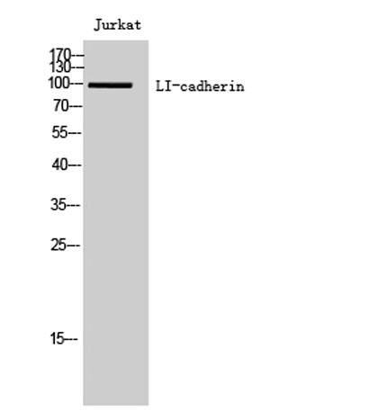 Western Blot analysis of Jurkat cells using LI-cadherin Polyclonal Antibody