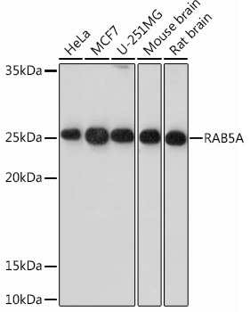 Western blot analysis of extracts of various cell lines, using RAB5AA Rabbit mAb at 1:1000
dilution.
Secondary antibody: HRP Goat Anti-Rabbit IgG (H+L) at 1:10000 dilution.
Lysates/proteins: 25ug per lane.
Blocking buffer: 3% nonfat dry milk in TBST.
Detection: ECL West Pico plus.
Exposure time: 30s.