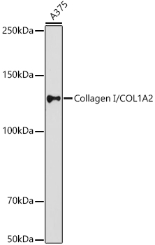 Western blot analysis of extracts of A375 cells, using Collagen I/COL1A2 antibody at 1:1000
dilution.
Secondary antibody: HRP Goat Anti-Rabbit IgG (H+L) at 1:10000 dilution.
Lysates/proteins: 25ug per lane.
Blocking buffer: 3% nonfat dry milk in TBST.
Detection: ECL West Pico Plus.
Exposure time: 180s.