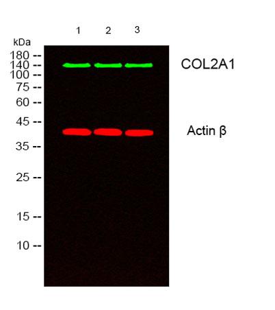 Western blot analysis of lysates from 1) k562 , 2) COLO205,3) MCF-7 cells,
Green) primary antibody was diluted at 1:1000, 4°over night, secondary antibody was diluted at 1:10000, 37° 1hour.
Red) Actin β Monoclonal Antibody(5B7)