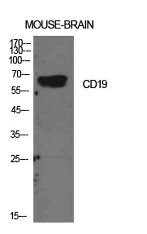 Western Blot analysis of mouse brain cells using CD19 Polyclonal Antibody. Antibody was diluted at 1:2000.
Secondary antibody was diluted at 1:20000