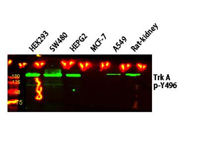 Western blot analysis of various lysates. Primary antibody was diluted at 1:1000, 4° over night, secondary antibody was diluted at 1:10000, 37° 1hour.