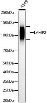Western blot analysis of various lysates, using LAMP2 antibody at1:40000 dilution.
Secondary antibody: HRP Goat Anti-Rabbit IgG (H+L) at 1:10000 dilution.
Lysates/proteins: 25ug per lane.
Blocking buffer: 3% nonfat dry milk in TBST.
Detection: ECL West Pico Plus.
Exposure time: 30s.