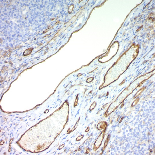 Formalin-fixed, paraffin-embedded tonsil stained with CD31; Clone JC/70A.
