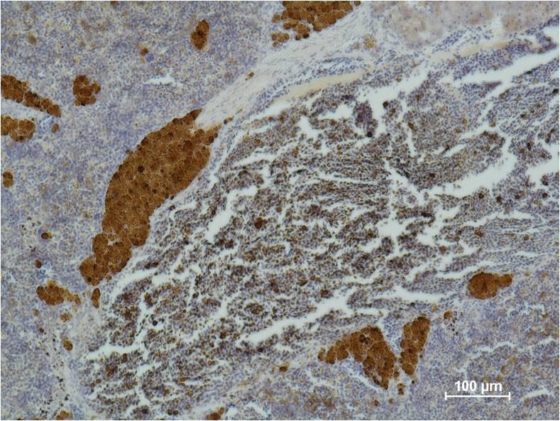 Immunohistochemical analysis of paraffin-embedded Mouse SpleenTissue using CD 25 Mouse mAbdiluted at:500.