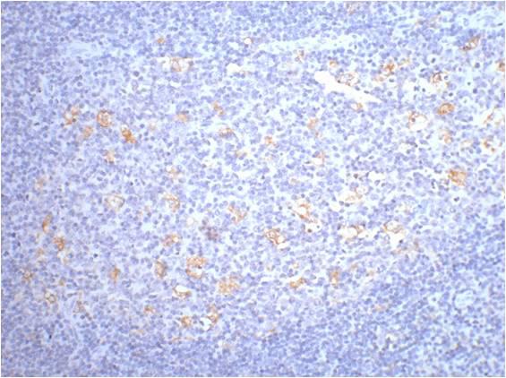IHC staining of human tonsil tissue with CD68 mouse mAb diluted at:200.