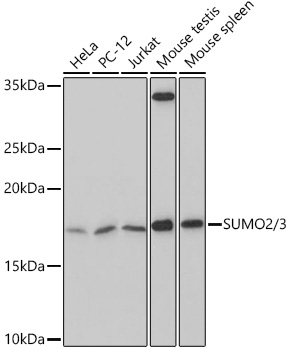 Western blot analysis of extracts of various cell lines, using SUMO2/3 Rabbit pAb at 1:500
dilution.
Secondary antibody: HRP Goat Anti-Rabbit IgG (H+L) at 1:10000 dilution.
Lysates/proteins: 25μg per lane.
Blocking buffer: 3% nonfat dry milk in TBST.
Detection: ECL West Pico Plus.
Exposure time: 3min.