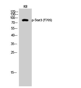 Western Blot analysis of KB cells using Phospho-Stat3 (Y705) Polyclonal Antibody diluted at 1:2000