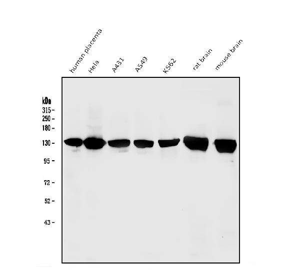 Western blot analysis of mGluR1/GRM1 using antimGluR1/ GRM1 antibody.
Electrophoresis was performed on a 5-20% SDS-PAGE gel at 70V (Stacking gel) / 90V (Resolving gel) for 2-3 hours. The
sample well of each lane was loaded with 50ug of sample under reducing conditions.
Lane 1: human placenta tissue lysates,
Lane 2: human Hela whole cell lysates,
Lane 3: human A431 whole cell lysates,
Lane 4: human A549 whole cell lysates,
Lane 5: human K562 whole cell lysates,
Lane 6: rat brain tissue lysates,
Lane 7: mouse brain tissue lysates.
After Electrophoresis, proteins were transferred to a Nitrocellulose membrane at 150mA for 50-90 minutes.
Blocked the membrane with 5% Non-fat Milk/ TBS for 1.5 hour at RT. The membrane was incubated with rabbit antimGluR1/
GRM1 antigen affinity purified polyclonal antibody at 0.25 ug/mL overnight at 4°C, then washed with TBS-0.1%Tween 3 times with 5 minutes each and probed with a goat anti-rabbit IgG-HRP secondary antibody at a dilution of 1:10000 for 1.5 hour at RT. The signal is developed using an Enhanced Chemiluminescent detection (ECL) kit with Tanon 5200 system. A specific band was detected for mGluR1/GRM1 at approximately 132KD. The expected band size for mGluR1/GRM1 is at 132KD.