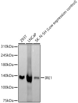 Western blot analysis of various lysates, using IRE1 antibody  at 1:1000 dilution.
Secondary antibody: HRP Goat Anti-Rabbit IgG (H+L)  at 1:10000 dilution.
Lysates/proteins: 25μg per lane. 
Blocking buffer: 3% nonfat dry milk in TBST. 
Detection: ECL West Pico Plus. 
Exposure time: 60s.