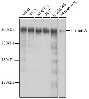 Western blot analysis of extracts of various cell lines, using Filamin A antibody at 1:1000
dilution.
Secondary antibody: HRP Goat Anti-Rabbit IgG (H+L) at 1:10000 dilution.
Lysates/proteins: 25μg per lane.
Blocking buffer: 3% nonfat dry milk in TBST.
Detection: ECL West Pico Plus.
Exposure time: 30s.