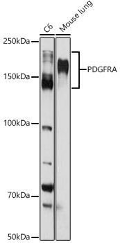 Western blot analysis of extracts of various cell lines, using PDGFR alpha antibody at 1:1000
dilution.
Secondary antibody: HRP Goat Anti-Rabbit IgG (H+L) at 1:10000 dilution.
Lysates/proteins: 25μg per lane.
Blocking buffer: 3% nonfat dry milk in TBST.
Detection: ECL West Pico Plus.
Exposure time: 30s.