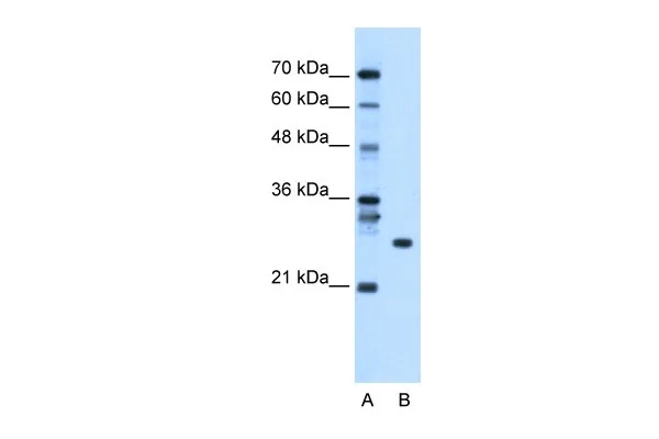WB Suggested Anti-RBPMS Antibody Titration: 0.5ug/ml
Positive Control: Human Liver
