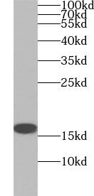 HEK-293 cells were subjected to SDS PAGE followed by western blot with (P16 antibody) at dilution of 1:1000