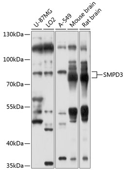 Western blot analysis of extracts of various cell lines, using SMPD3 antibody at 1:1000
dilution.
Secondary antibody: HRP Goat Anti-Rabbit IgG (H+L) at 1:10000 dilution.
Lysates/proteins: 25μg per lane.
Blocking buffer: 3% nonfat dry milk in TBST.
Detection: ECl West Pico Plus.  
Exposure time: 10s.