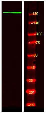 Western Blot analysis of Hela treated or untreated by LPS lysis, using primary antibody at 1:1000 dilution.
Secondary antibody was diluted at 1:10000.