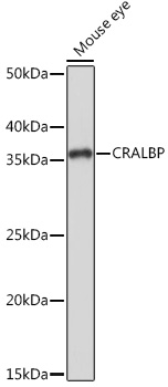 Western blot analysis of extracts of Mouse eye, using CRALBP Rabbit mAb at 1:1000 dilution.
Secondary antibody: HRP Goat Anti-Rabbit IgG (H+L) at 1:10000 dilution.
Lysates/proteins: 25μg per lane.
Blocking buffer: 3% nonfat dry milk in TBST.
Detection: ECL West Pico Plus.
Exposure time: 1s.