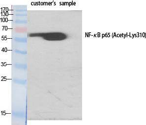 Western Blot analysis of various cells using Acetyl-NFκB-p65 Polyclonal Antibody diluted at 1:1000.