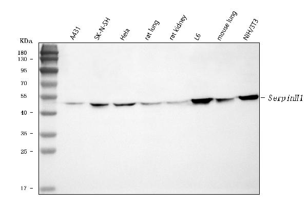 Western blot analysis of Hsp47/SERPINH1 using anti-Hsp47/SERPINH1 antibody.
Electrophoresis was performed on a 5-20% SDS-PAGE gel at
70V (Stacking gel) / 90V (Resolving gel) for 2-3 hours. The sample well of each lane was loaded with 30 ug of sample
under reducing conditions.
Lane 1: human A431 whole cell lysates,
Lane 2: human SK-N-SH whole cell lysates,
Lane 3: human Hela whole cell lysates,
Lane 4: rat lung tissue lysates,
Lane 5: rat kidney tissue lysates,
Lane 6: rat L6 whole cell lysates,
Lane 7: mouse lung tissue lysates,
Lane 8: mouse NIH/3T3 whole cell lysates.
After electrophoresis, proteins were transferred to a nitrocellulose membrane at 150 mA for 50-90 minutes.
Blocked the membrane with 5% non-fat milk/TBS for 1.5 hour at RT. The membrane was incubated with rabbit anti-
Hsp47/SERPINH1 antigen affinity purified polyclonal antibody at 0.5 ug/mL overnight at 4°C, then washed with TBS-0.1%Tween 3 times with 5 minutes each and probed with a goat anti-rabbit IgG-HRP secondary antibody at a dilution of 1:5000 for 1.5 hour at RT. The signal is developed using an Enhanced Chemiluminescent detection (ECL) kit with Tanon 5200 system. A specific band was detected for Hsp47/SERPINH1 at approximately 46 kDa. The expected band size for Hsp47/SERPINH1 is at 46 kDa.