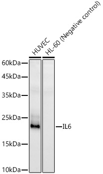 Western blot analysis of various lysates, using IL6 Rabbit pAb  at 1:1000 dilution.
Secondary antibody: HRP Goat Anti-Rabbit IgG (H+L)  at 1:10000 dilution.
Lysates/proteins: 25ug per lane.
Blocking buffer: 3% nonfat dry milk in TBST.
Detection: ECL West Pico Plus. 
Exposure time: 90s.