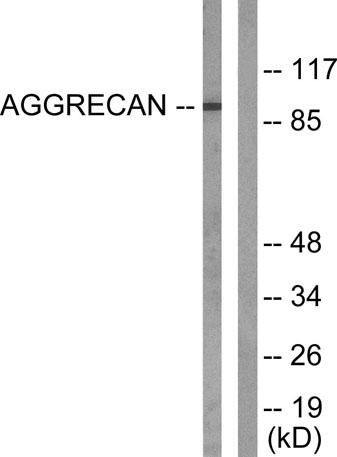 Western blot analysis of lysates from Jurkat cells, treated with Etoposide 25uM 60', using Aggrecan (Cleaved-Asp369) Antibody. The lane on the right is blocked with the synthesized peptide.