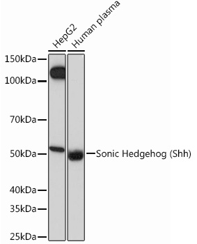 Western blot analysis of various lysates using Sonic Hedgehog (Shh) Rabbit mAb at 1:1000 dilution.
Secondary antibody: HRP Goat Anti-Rabbit IgG (H+L) at 1:10000 dilution.
Lysates/proteins: 25μg per lane.
Blocking buffer: 3% nonfat dry milk in TBST.
Detection: ECL West Pico Plus.
Exposure time: 60s.