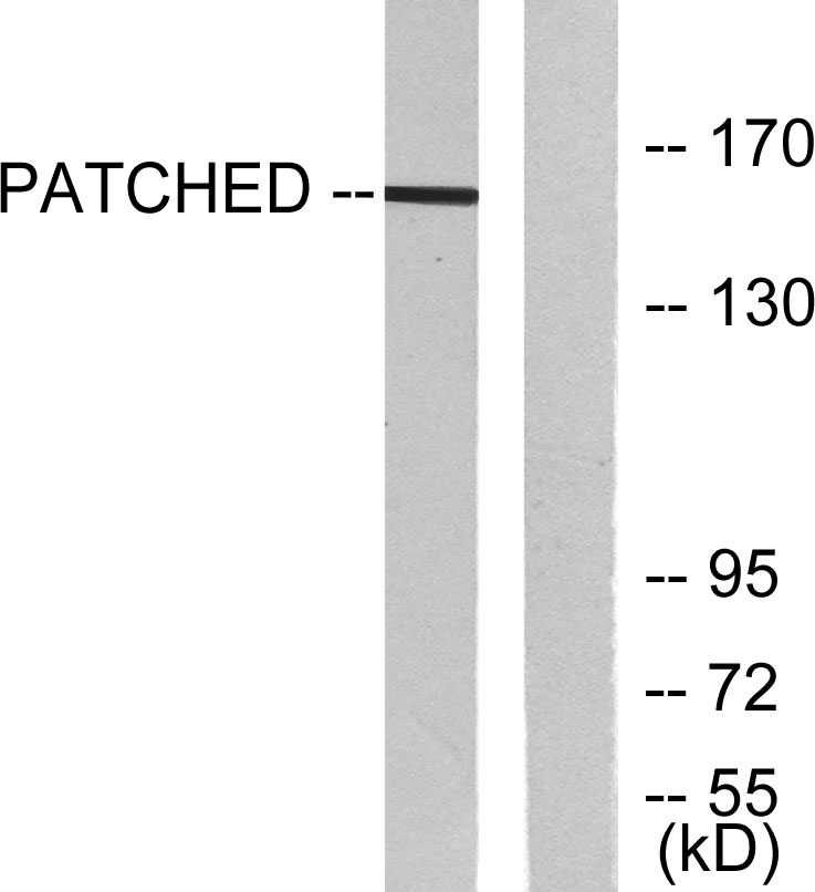 Western blot analysis of lysates from mouse muscle cells, using Patched Antibody. The lane on the right is blocked with the synthesized peptide.