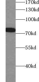 Jurkat cells were subjected to SDS PAGE followed by western blot with CD86 antibody at dilution of 1:500