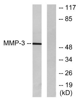 Western blot analysis of lysates from 293 cells, using MMP-3 Antibody.
The lane on the right is blocked with the synthesized peptide.