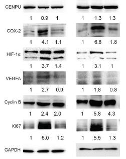 Zhao, Shaorong et al. “Deciphering the performance of polo-like kinase 1
in triple-negative breast cancer progression according to the centromere protein
phosphorylation pathway.” American journal of cancer research
vol. 11,5 2142-2158. 15 May. 2021