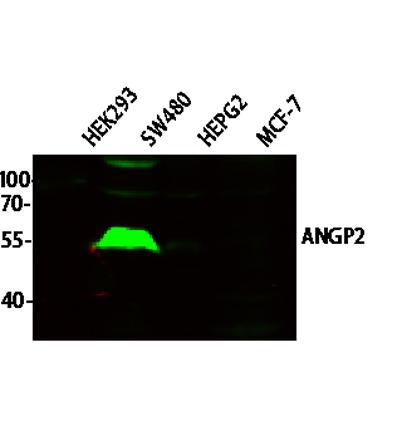 Western blot analysis of various lysates, primary antibody was diluted at 1:1000, 4° over night, secondary
antibody was diluted at 1:10000, 37° 1hour.