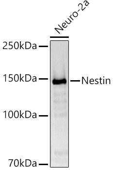 Western blot analysis of lysates from Neuro-2a cells, using Nestin Rabbit pAb at 1:1000 dilution.
Secondary antibody: HRP Goat Anti-Rabbit IgG (H+L)at 1:10000 dilution.
Lysates/proteins: 25μg per lane.
Blocking buffer: 3% nonfat dry milk in TBST.
Detection: ECL West Pico Plus.
Exposure time: 3s.