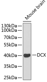 Western blot analysis of extracts of mouse brain, using Doublecortin antibody.
Secondary antibody: HRP Goat Anti-Rabbit IgG (H+L) at 1:10000 dilution.
Lysates/proteins: 25μg per lane.
Blocking buffer: 3% nonfat dry milk in TBST.