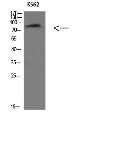 Western Blot analysis of K562 cells using Villin Polyclonal Antibody diluted at 1:500. Secondary antibody was diluted at 1:20000