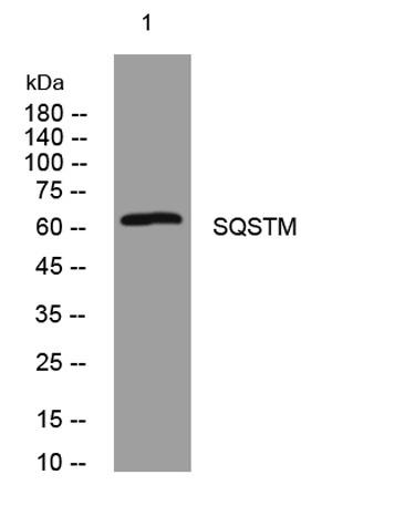 Anti-SQSTM1/p62 antibody, Western blotting
Lane 1: Rat Brain Tissue Lysate
Lane 2: HELA Cell Lysate
Lane 3: U87 Cell Lysate
Lane 4: A549 Cell Lysate